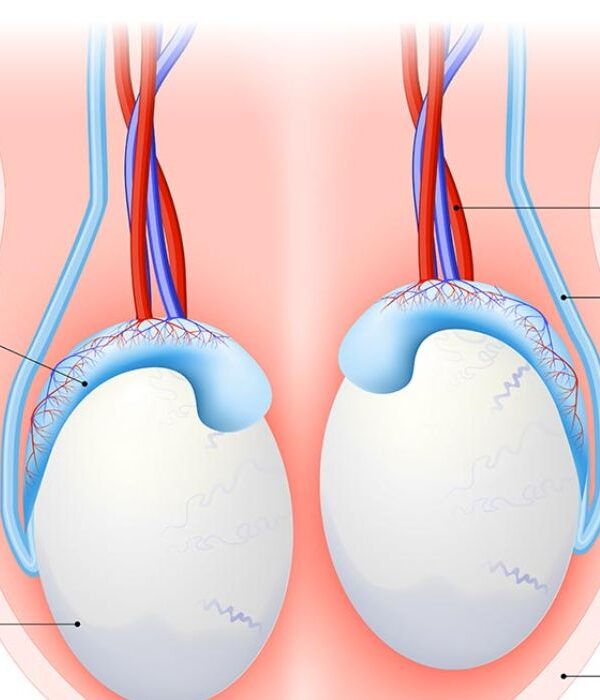 أسباب تورم الخصية بعد عملية الدعامة الذكرية