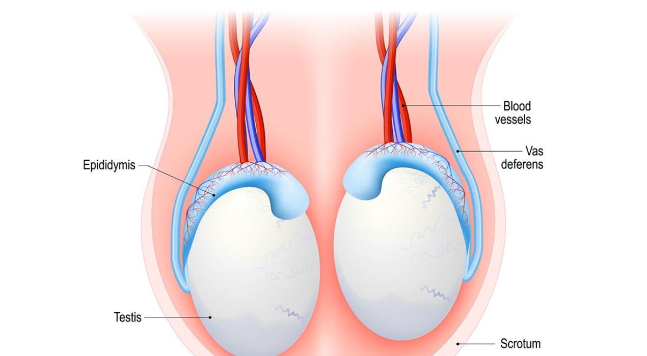 أسباب تورم الخصية بعد عملية الدعامة الذكرية