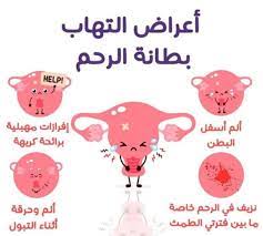 أعراض التهاب الرحم عند البنات