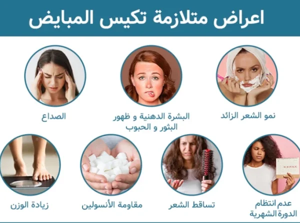 أعراض تكيس المبايض الخفيف