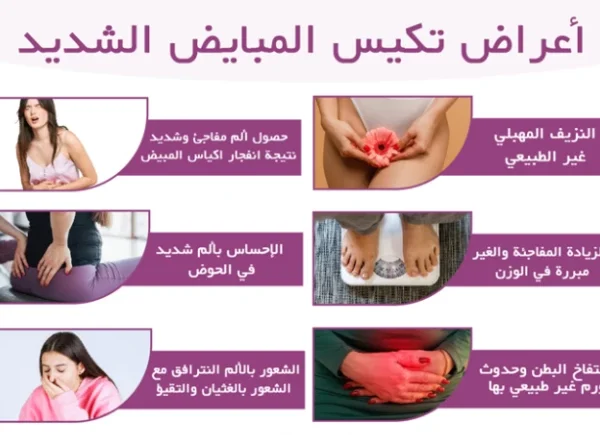 أعراض تكيس المبايض الشديد