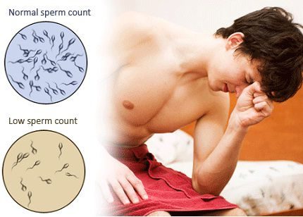 اسباب تشوهات الحيوانات المنويه