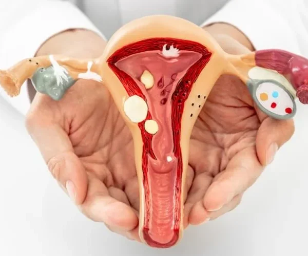 التهاب الرحم والمبايض