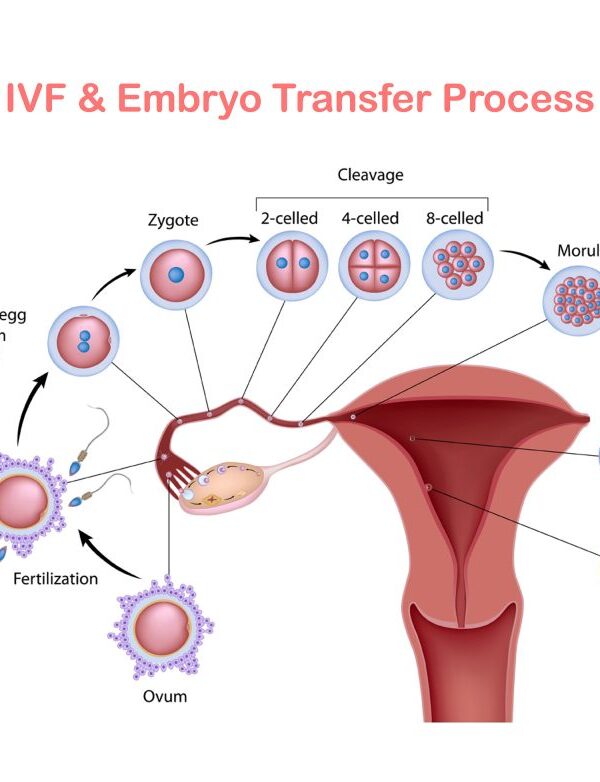 الجديد في علاج العقم عند النساء
