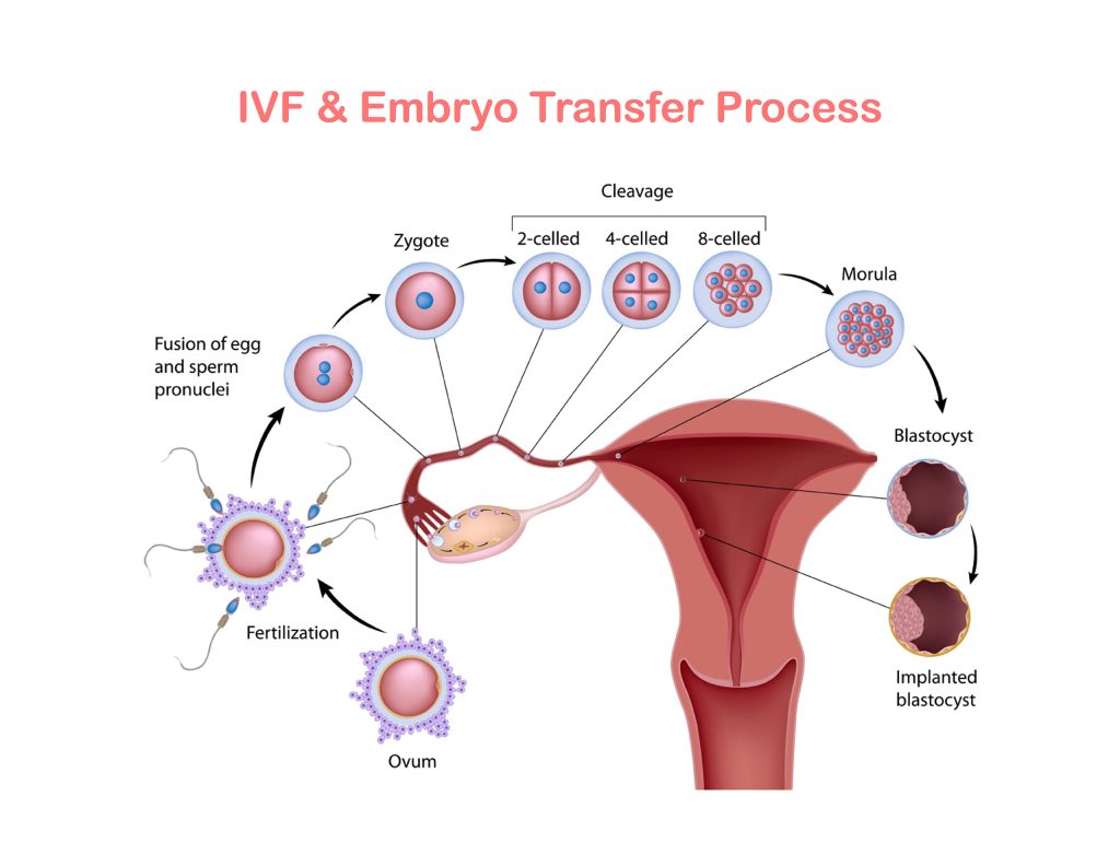 العقم عند النساء