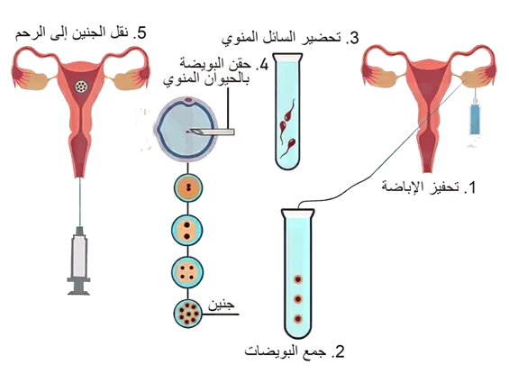 بعد الحقن الصناعي متى اقدر اسوي تحليل حمل