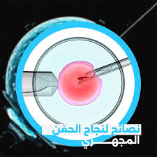 تجربتي مع الحقن المجهري بالتفصيل