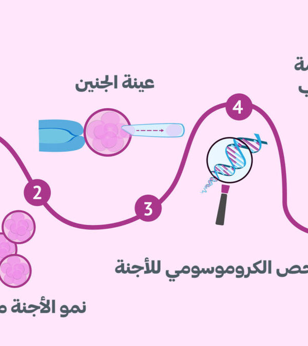 تحديد نوع الجنين