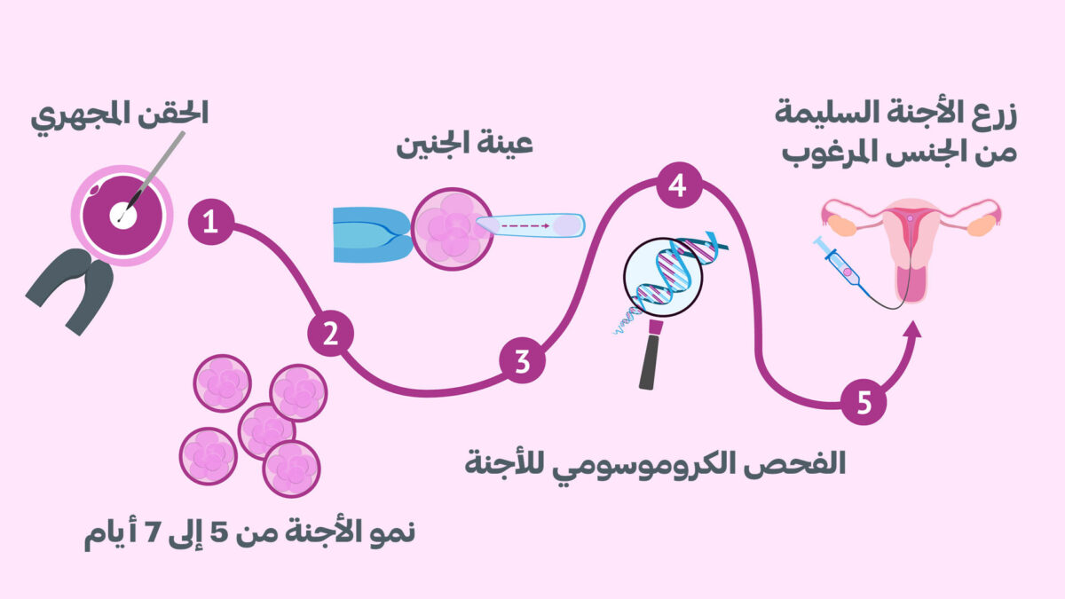 تحديد نوع الجنين