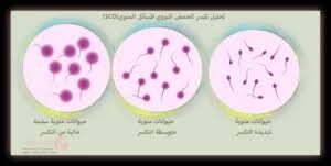 تحليل البويضات والحيوانات المنوية