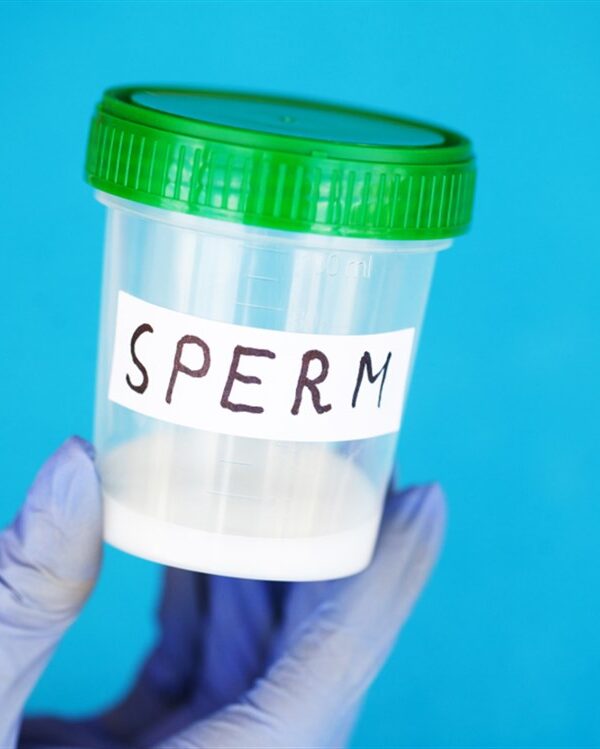 تحليل السائل المنوى للرجل
