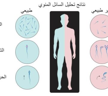 تحليل السائل المنوي