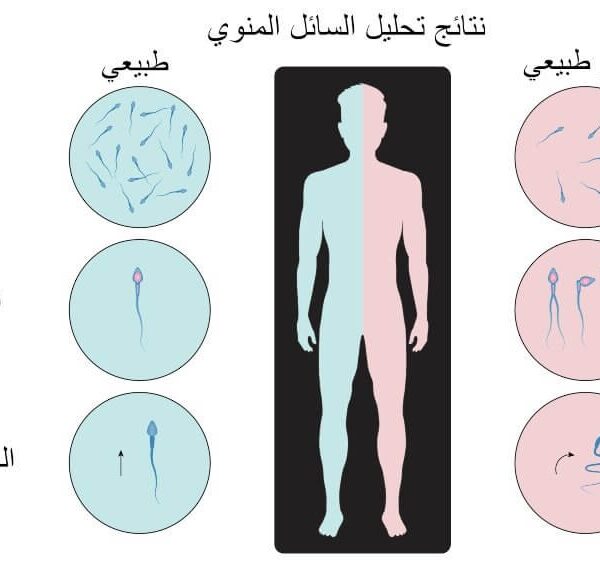 تحليل السائل المنوي