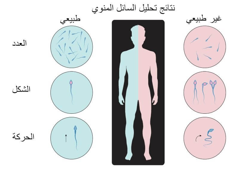 تحليل السائل المنوي