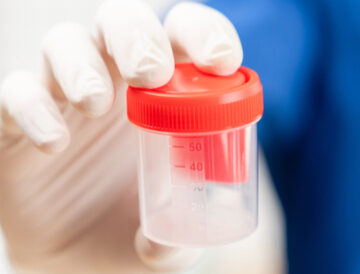 سعر تحليل الخصوبة للرجال