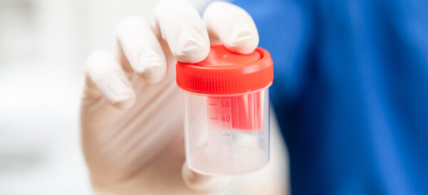 سعر تحليل الخصوبة للرجال