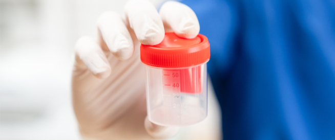 سعر تحليل الخصوبة للرجال