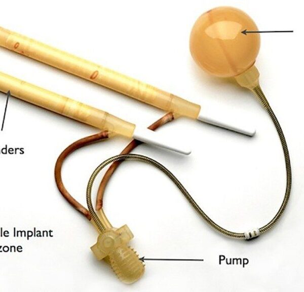 تركيب الدعامة الذكرية