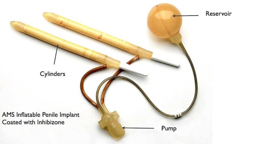 تركيب الدعامة الذكرية