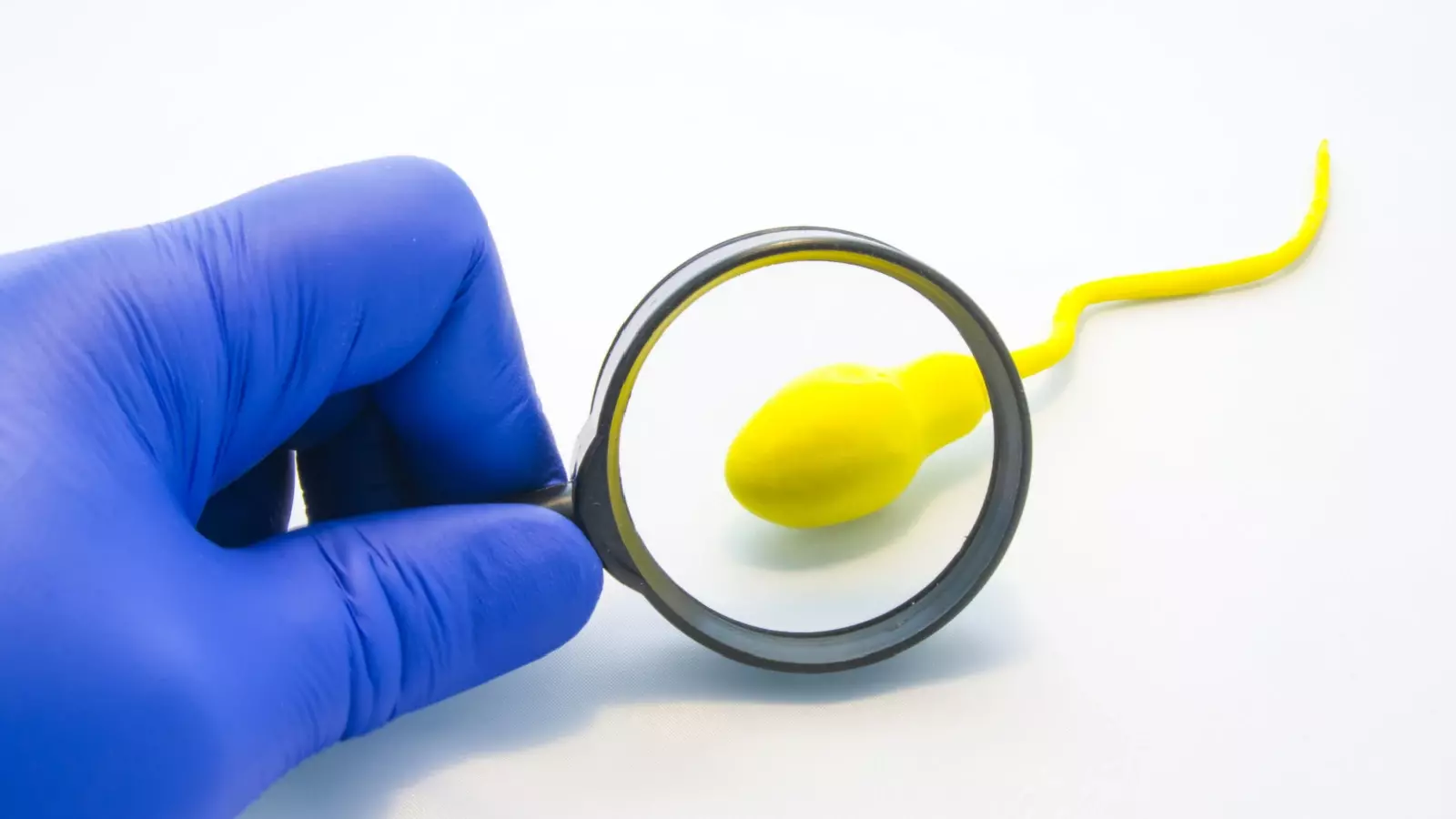 سبب تشوهات الحيوانات المنوية