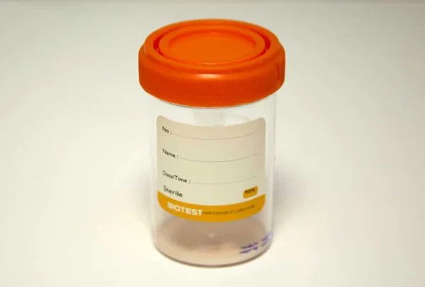 شروط تحليل السائل المنوى