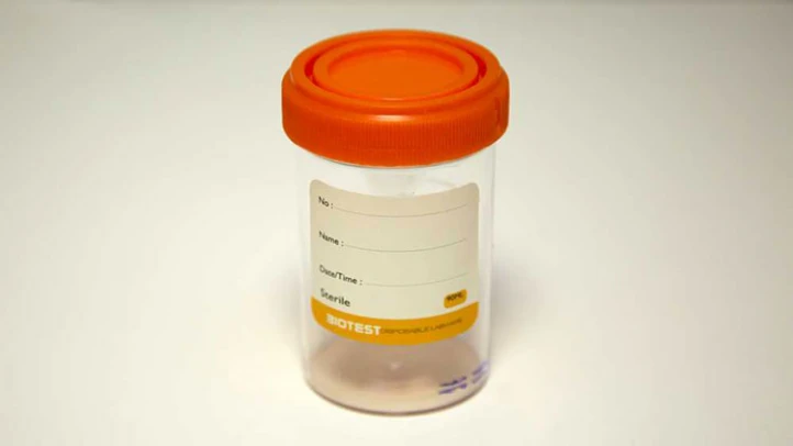 شروط تحليل السائل المنوى