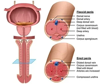 شكل الدعامه الذكريه