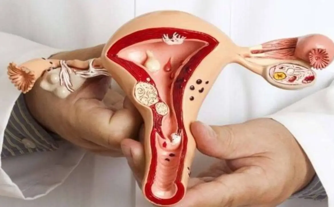 عدوى المهبل البكتيرية