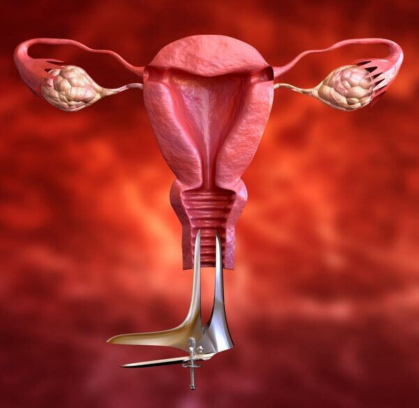 علاج التهاب الرحم