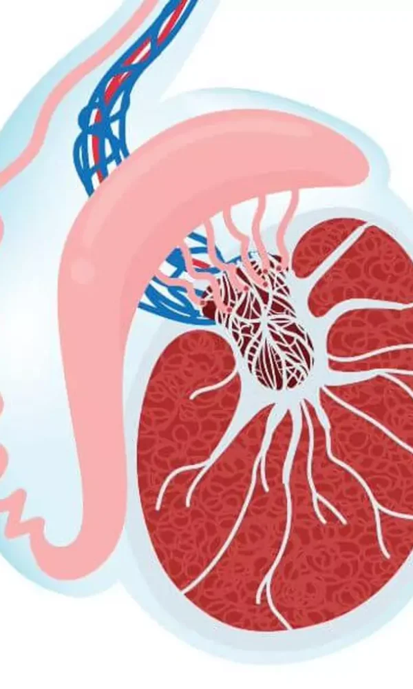 علاج الخصية المعلقة بدون جراحة