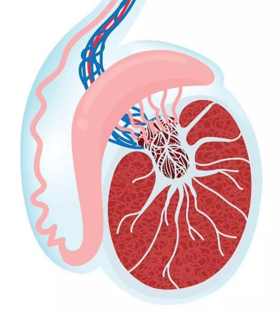 علاج الخصية المعلقة بدون جراحة