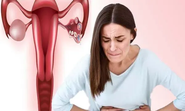 علامات تكيس المبايض عند المتزوجات