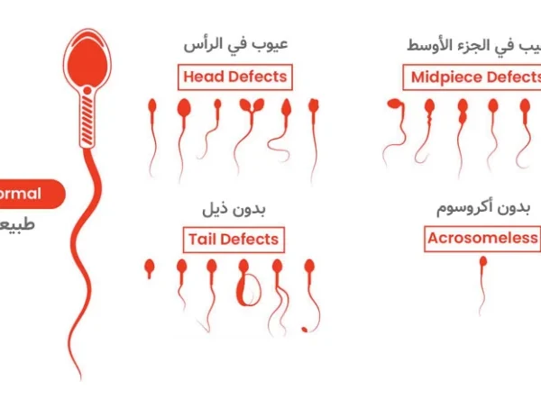 علامات ضعف الخصوبة عند الرجل