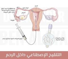 علامات نجاح الحقن الصناعي