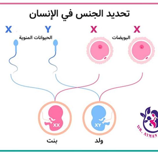 عملية تحديد نوع الجنين