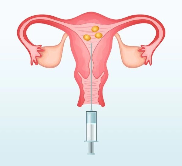 كم تستغرق عملية الحقن المجهري